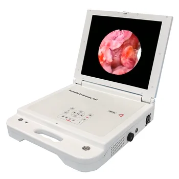 Жесткая назофарингоскопическая оптическая эндоскопическая совместимая портативная ЛОР-эндоскопическая система камер